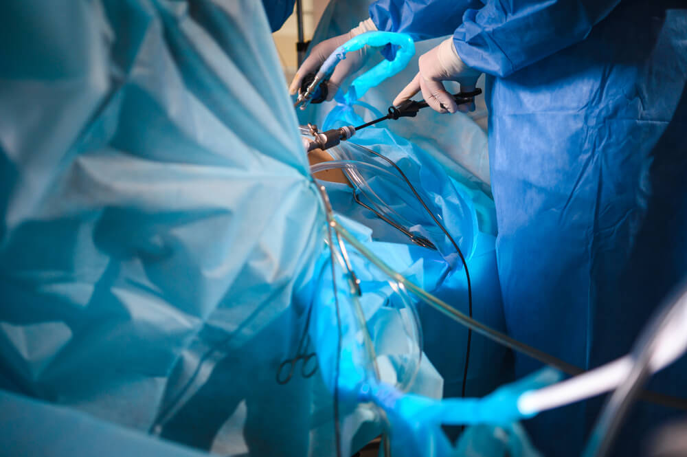 operacja usunięcia macicy laparoskopowo